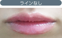 ラインなし
