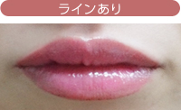 ラインあり